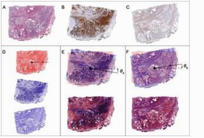 Digital Pathology Quantitative Immunohistochemistry Software 20100031