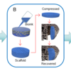 Flow diagram of shape memory 3D scaffold filling bone defect. Flow diagram of shape memory 3D scaffold filling bone defect.