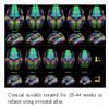 Cortical models created for 28-44 weeks in infants using neonatal atlas. Cortical models created for 28-44 weeks in infants using neonatal atlas.