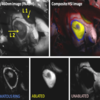 Fig. 1. UV light as an excitation source to reveal lesions. Fig. 1. UV light as an excitation source to reveal lesions.