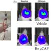 In vivo bioluminescence imaging shows reduction of glioblastoma tumor volume with He CAP treatment compared to the vehicle control (treated with only helium). In vivo bioluminescence imaging shows reduction of glioblastoma tumor volume with He CAP treatment compared to the vehicle control (treated with only helium).