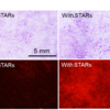 Figure 1: Top Row: schematic of enhanced skin delivery with STAR particles; en face images of skin stained with purple dye to visualize microscopic puncture sites without and with STAR particle pretreatment (respectively); and a U.S. penny with polymeric STAR particles. Bottom Row: A six-sided STAR particle on a fingertip; fluorescent dye delivered into skin without and with STAR particle pretreatment (respectively); and rat skin looks unchanged after STAR treatment (i.e., no skin irritation).
