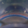 fig 1a