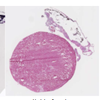 6 weeks after implantation.This image shows maintenance of high cell viability and improvement of myocardial infarction. 6 weeks after implantation. The images show maintenance of high cell viability and improvement of myocardial infarction.