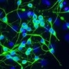 Human Embryonic Stem Cells stem cells hESC