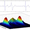 Spectral ECG analysis A raw ECG signal can be decomposed by a spectral transform to reveal frequency information while retaining data on phase and amplitude