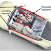 Different possible wearable embodiments and mounting locations as universal countermeasures for motion sickness.
Vehicle interior wearable embodiment motion sickness countermeasure; provided to the Fellow with the IR as additional information.